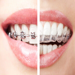 orthodontic3 (1)